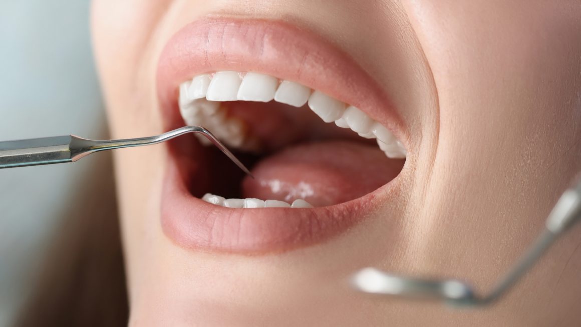 1.2 ตรวจสุขภาพช่องปาก ตรวจสุขภาพช่องปาก