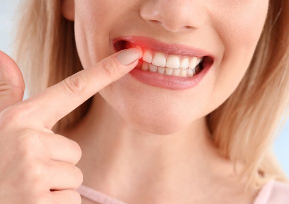 การรักษาโรคเหงือก