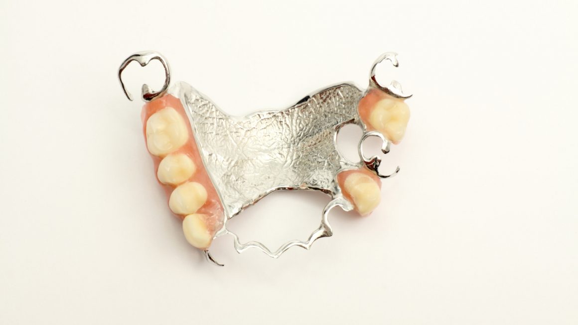 การทำฟันปลอม/ ฟันปลอมแบบถอดได้