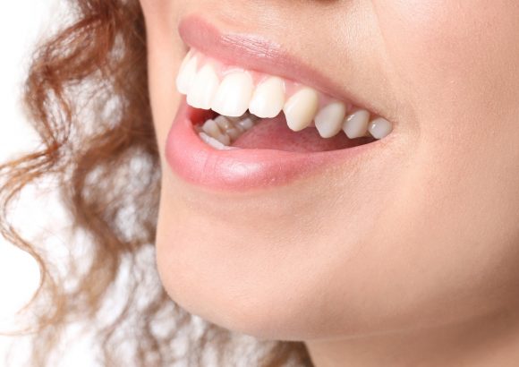 ตกแต่งเหงือก