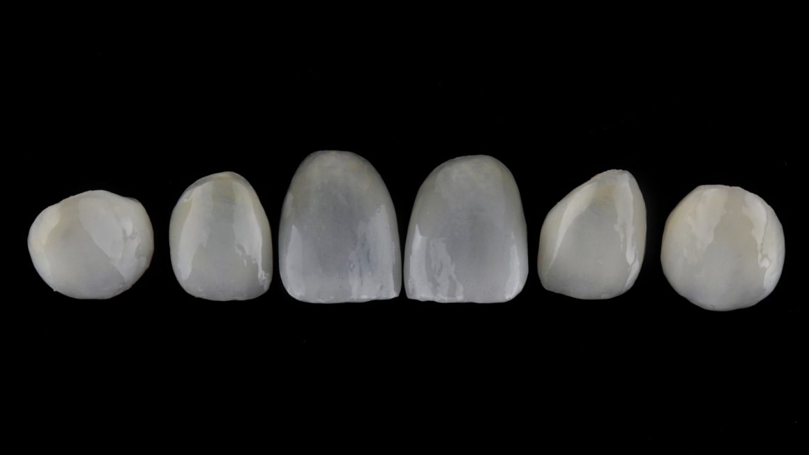 6.3 วีเนียร์ วีเนียร์