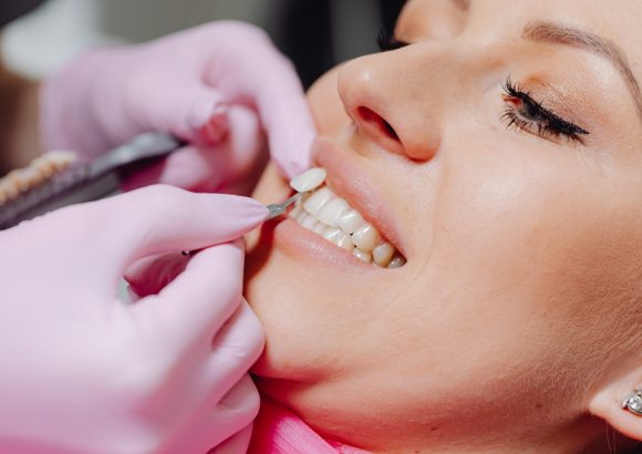 วีเนียร์